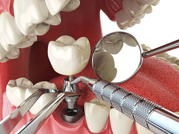 Best Emergency Dental Surgery in Ridgewood, NJ